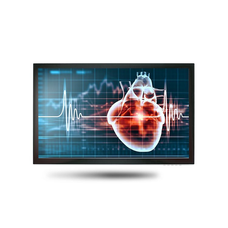 Onyx MEDDP-615 15.6in Medical Display 400 nits PCAP Touch VGA HDMI USB-C
